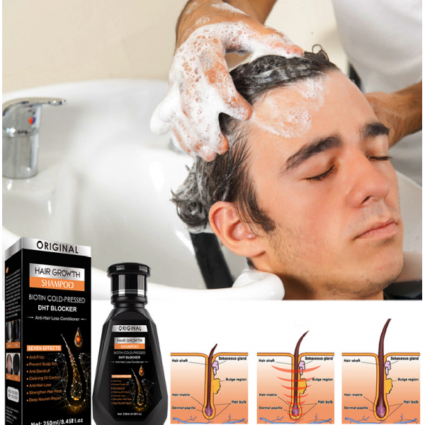 Шампунь для волосся від випадіння Original Anti - Hair Loss Growth Shampoo, з екстрактом женьшеню, 250 мл