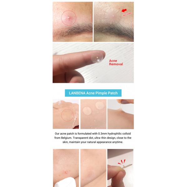 Патчі від акне Lanbena Acne Pimple Patch, 1 упаковка Патчі від акне Lanbena Acne Pimple Patch, 1 упаковка