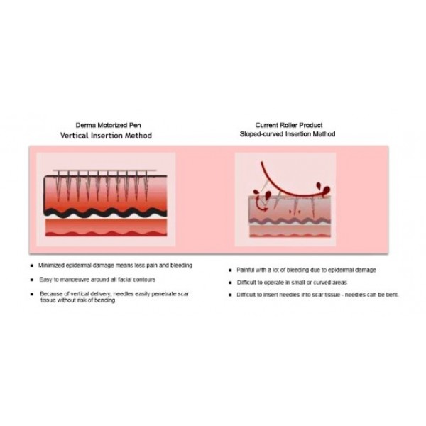 Картридж для дермапену, із гвинтовим кріпленням, Nano-mini, медична сталь