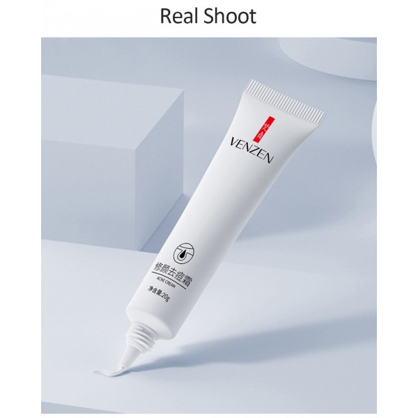 Крем від акне точковий, Venzen Acne Cream, з нікотинамідом, 20 г