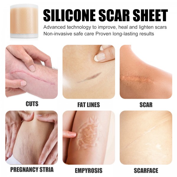 Пластир силіконовий від шрамів та рубців West&Month Silicone Scar Sheets, гель-пластир від шрамів, тілесний, 4 см х 1,5 м