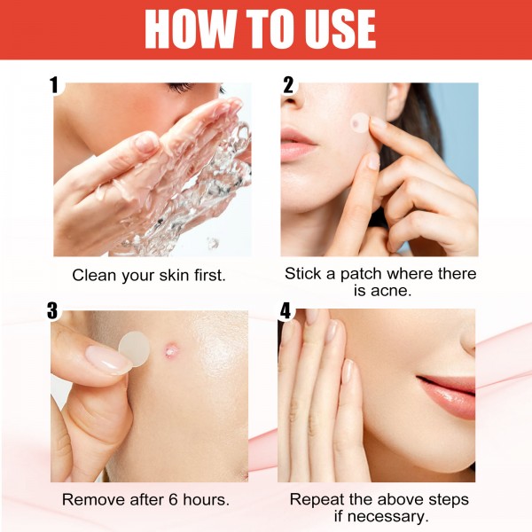 Патчі від акне EELHOE Hydrocolloid Acne Patch, гідроколоїдний пластир від прищів, 144 шт Патчі від акне EELHOE Hydrocolloid Acne Patch, гідроколоїдний пластир від прищів, 144 шт