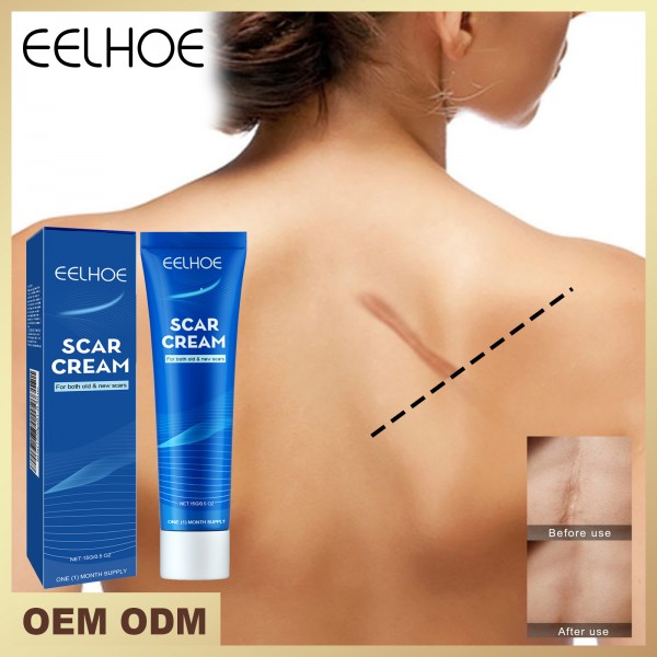 Крем для зменшення та розгладження шрамів і рубців EELHOE Scar Cream, 15 г Крем для зменшення та розгладження шрамів і рубців EELHOE Scar Cream, 15 г