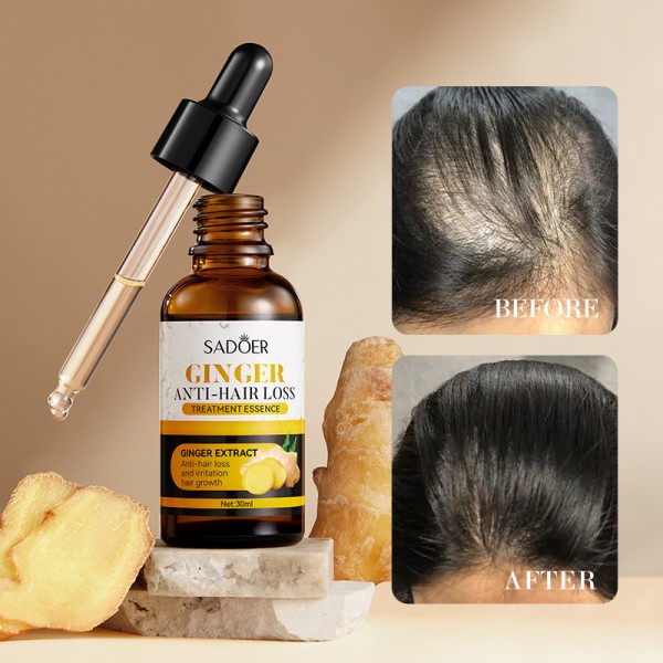 Сироватка для росту волосся з екстракту імбиру SADOER Ginger Anti-Hair Loss, сироватка проти випадіння волосся, 30 мл Сироватка для росту волосся з екстракту імбиру SADOER Ginger Anti-Hair Loss, сироватка проти випадіння волосся, 30 мл