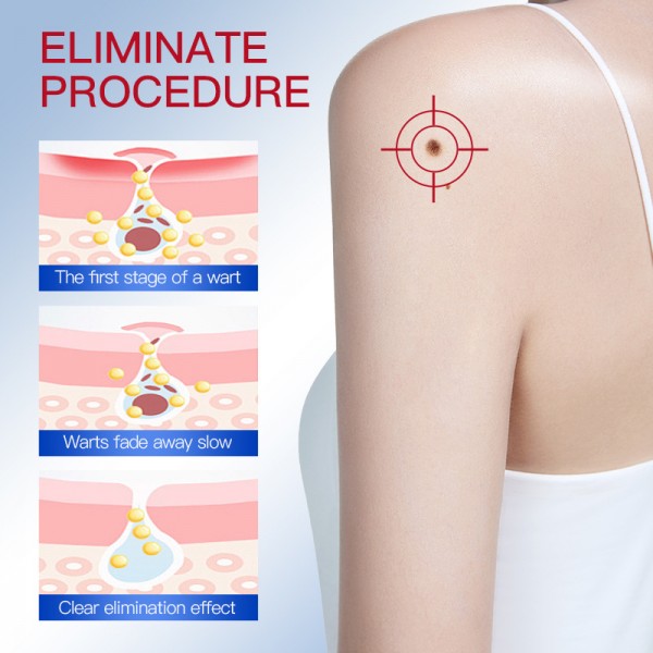 Сироватка для видалення бородавок у формі ручки SADOER Wart Remover, 2 мл Сироватка для видалення бородавок у формі ручки SADOER Wart Remover, 2 мл