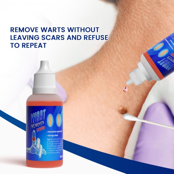 Рідина для видалення бородавок Sumifun Wart Remover, 20 мл