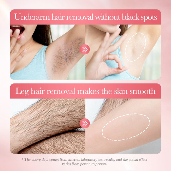 Пінка-мус для видалення волосся SADOER Hair Removal Mousse, крем для безболісної депіляції, 150 мл