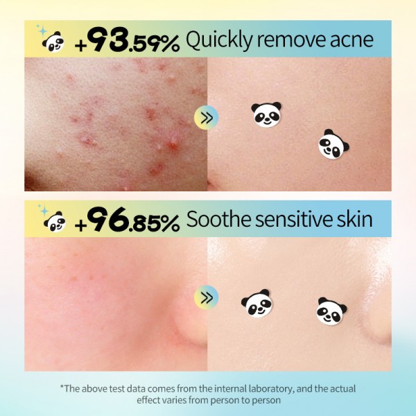 Патчи от акне в форме панды SADOER Panda Hydrocolloid Acne Patch, гидроколоидный пластырь от прыщей, 40 шт