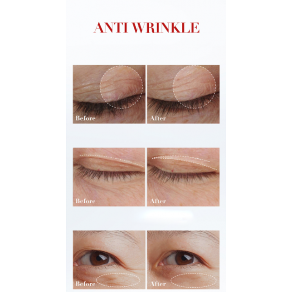 Крем для очей проти зморшок з ретинолом LUOFMISS, 30 г