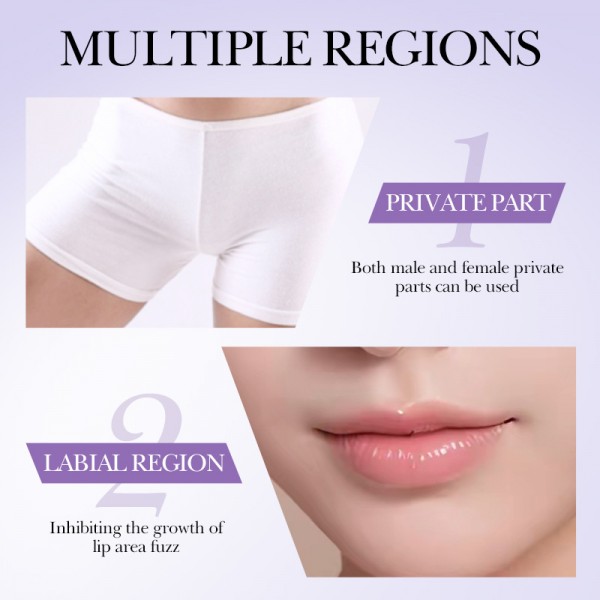 Спрей для гальмування росту волосся Sadoer, 30 мл