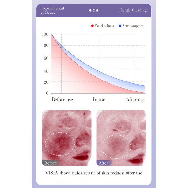 Гель для очищення обличчя з ретинолом Bioaqua Retinol Cleanser, 100 г Гель для очищення обличчя з ретинолом Bioaqua Retinol Cleanser, 100 г