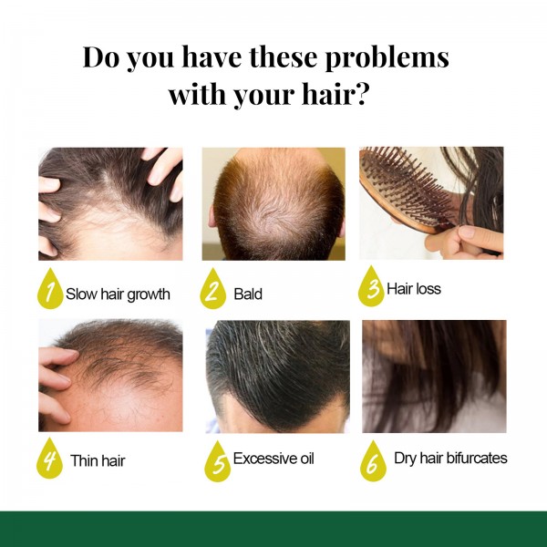 Масло для роста волос Eelhoe King of Ginger 7 Days Hair Nutrient Solution, 50 мл Масло для роста волос Eelhoe King of Ginger 7 Days Hair Nutrient Solution, 50 мл