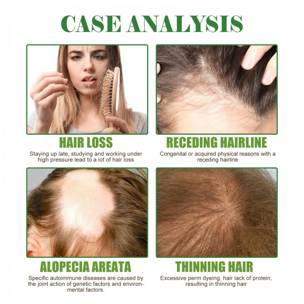 Масло для укрепления волос и ресниц с алое и розмарином Eelhoe Rosemary Mint Scalp & Hair Strengthening Oil, 60 мл