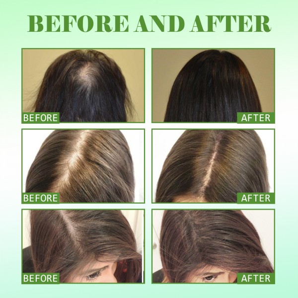 Масло для укрепления волос и ресниц с алое и розмарином Eelhoe Rosemary Mint Scalp & Hair Strengthening Oil, 60 мл