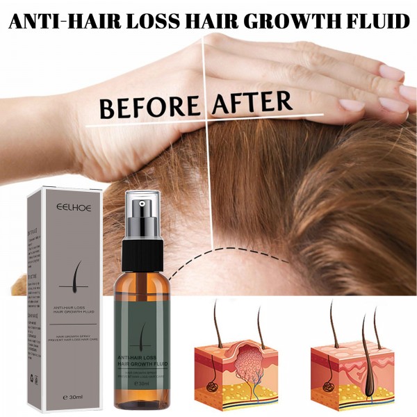 Флюид для роста волос Eelhoe Anti-Hair Loss Hair Growth Fluid, 30 мл