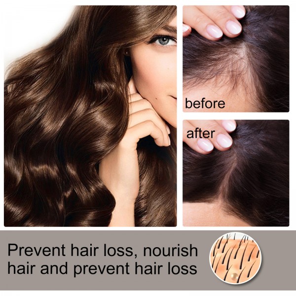 Флюид для роста волос Eelhoe Anti-Hair Loss Hair Growth Fluid, 30 мл