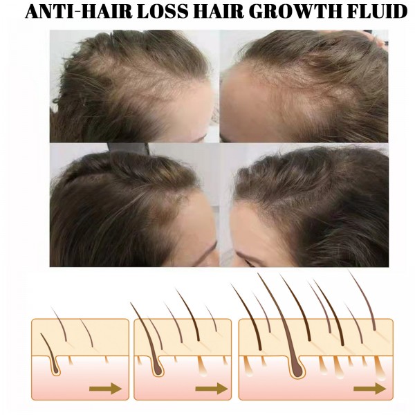 Флюид для роста волос Eelhoe Anti-Hair Loss Hair Growth Fluid, 30 мл