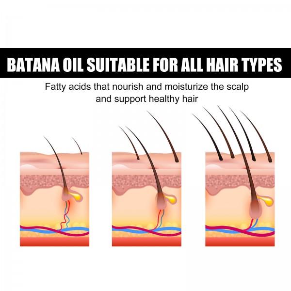 Флюїд для росту волосся Eelhoe Batana Oil, 30 мл Флюїд для росту волосся Eelhoe Batana Oil, 30 мл