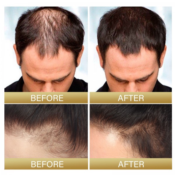 Флюїд для росту волосся Eelhoe Batana Oil, 30 мл Флюїд для росту волосся Eelhoe Batana Oil, 30 мл