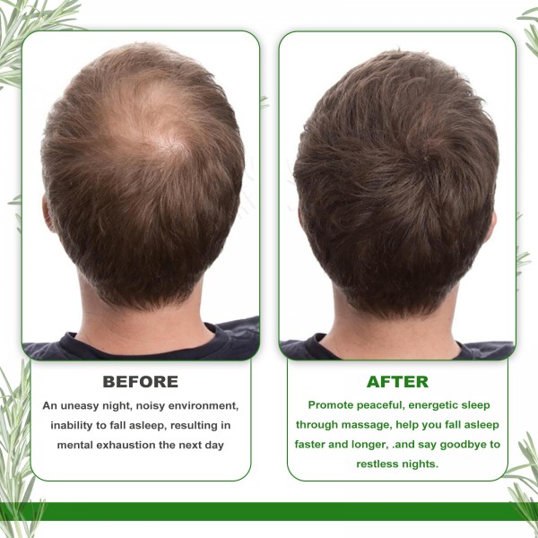 Масло для роста волос с розмарином Eelhoe Rosemary Essential Oil, 60 мл