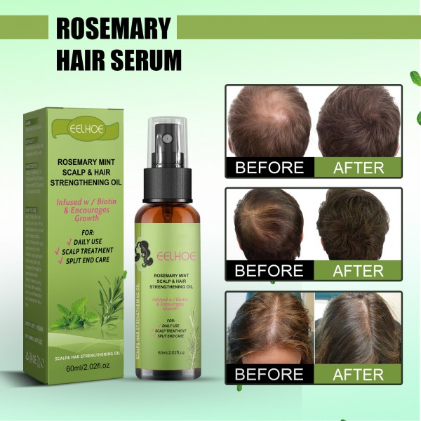 Флюїд для росту волосся Eelhoe Rosemary Mint Scalp & Hair Strengthening Oil, 60 мл