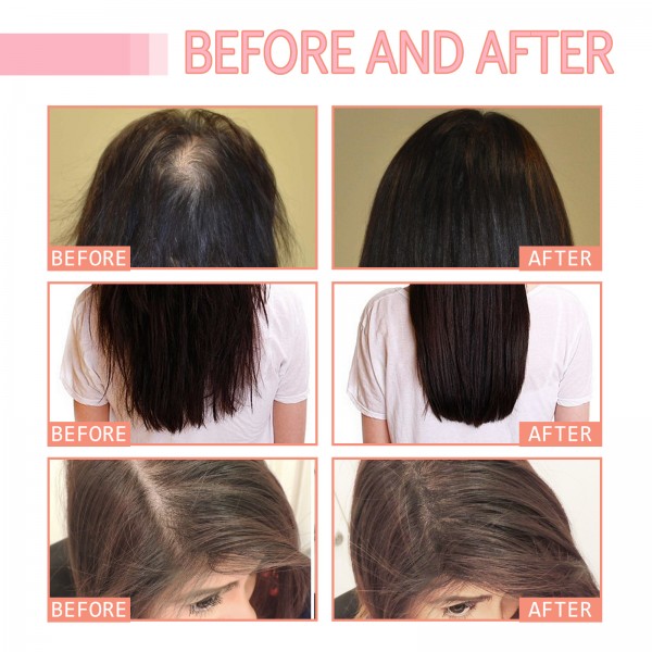 Лосьйон для росту волосся з грейпфрутом Eelhoe Grapefruit Thicker Hair Growth Lotion, 100 мл