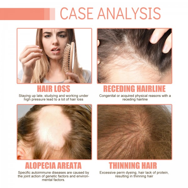 Лосьйон для росту волосся з грейпфрутом Eelhoe Grapefruit Thicker Hair Growth Lotion, 100 мл