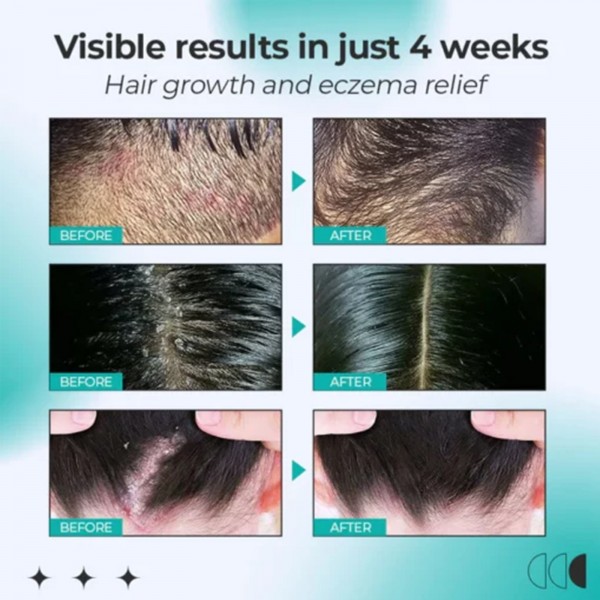 Масажер для шкіри голови Eelhoe Scalp Massager Roller, 18 мл Масажер для шкіри голови Eelhoe Scalp Massager Roller, 18 мл