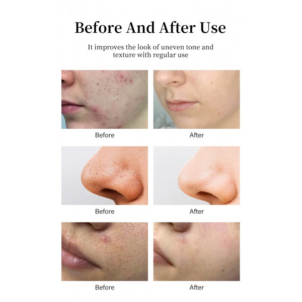 Тоник Mooyam Glycolic Acid 7% Toning Solution, 250 мл