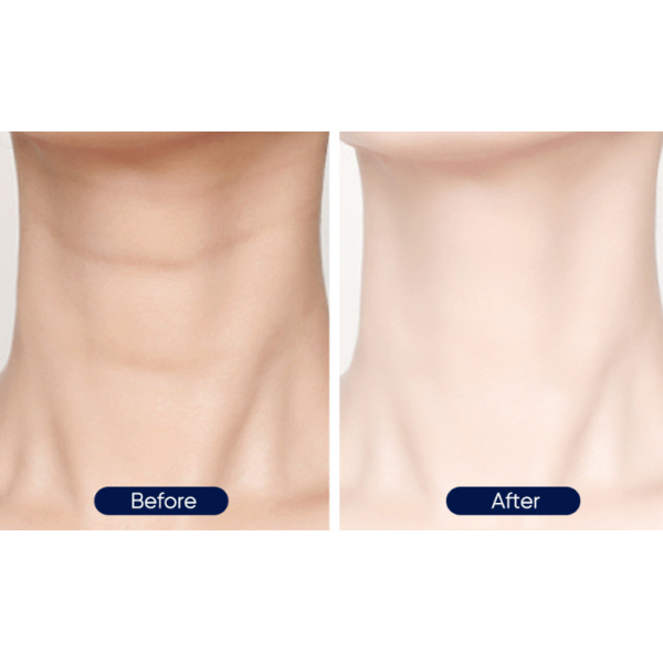 Крем для шиї Mooyam Neck Firming Lifting Cream, з ретинолом та колагеном, 50 мл