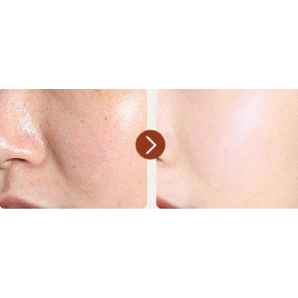 Тонер для обличчя антивіковий Irev Retinol Serum Toner, з ретинолом, 100 мл Тонер для обличчя антивіковий Irev Retinol Serum Toner, з ретинолом, 100 мл