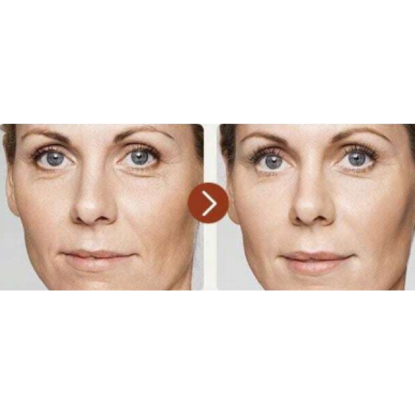 Тонер для обличчя антивіковий Irev Retinol Serum Toner, з ретинолом, 100 мл Тонер для обличчя антивіковий Irev Retinol Serum Toner, з ретинолом, 100 мл