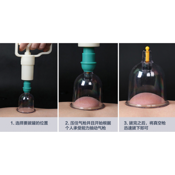 Банки вакуумні, банки масажні антицелюлітні з насосом, набір 24 шт