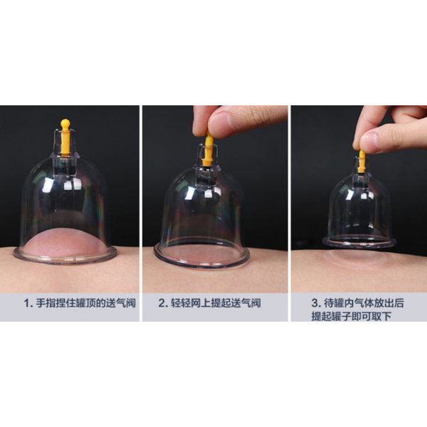 Банки вакуумні, банки масажні антицелюлітні з насосом, набір 24 шт