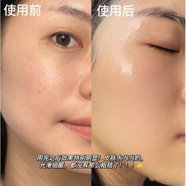 Маска з гіпоалергенного силікону, Gecomo Soft Mask, прозора, 21,5х29 см, 1 шт