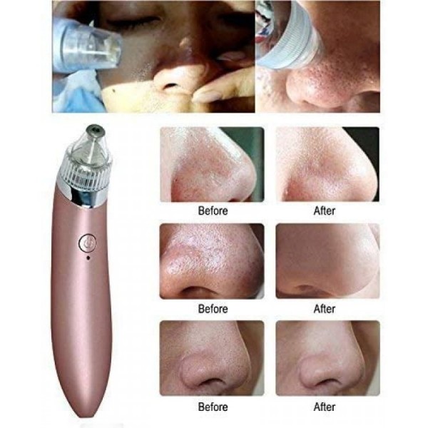 Вакуумний апарат для видалення чорних цяток, Beauty Skin Care Specialist XN-8030, професійний, 1 шт