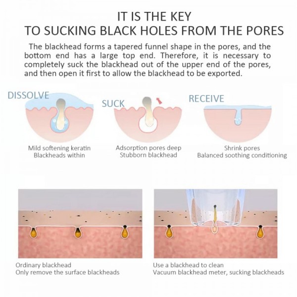 Вакуумний апарат для видалення чорних цяток, Beauty Skin Care Specialist XN-8030, професійний, 1 шт