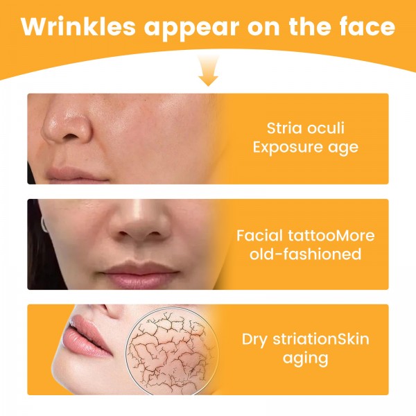 Тейп-пластир для корекції носогубних складок Eelhoe, 10 шт