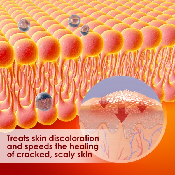 Крем від псоріазу, екземи, атопічного дерматиту Sumifun Psoriasis Cream, туба 20 г 