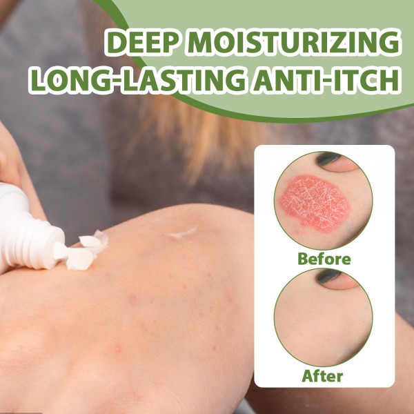 Крем протисвербіжний  від екземи Sumifun Tea Tree Balm Eczema Cream, з олією чайного дерева, 20 г 