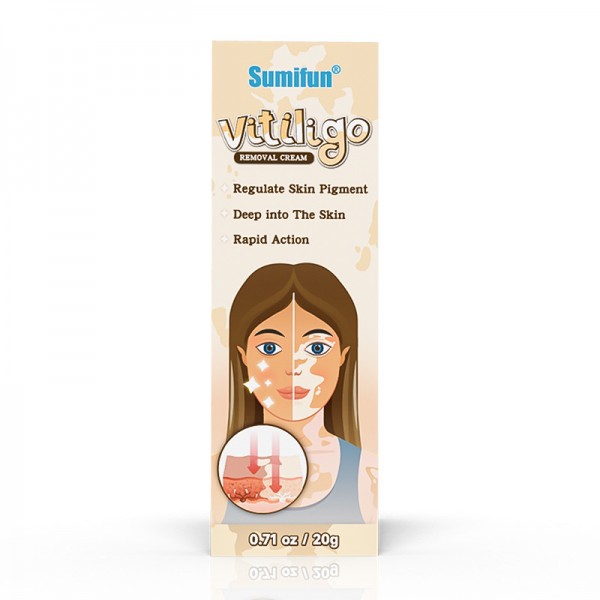 Крем зволожуючий від вітіліго, відновлення пігменту шкіри та зменшення білих плям Vitiligo Removal Cream, 20г