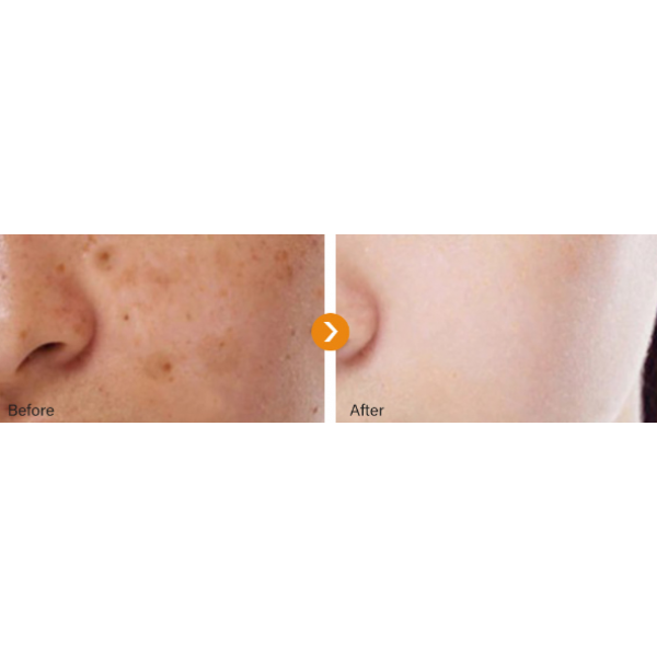 Крем відбілюючий для обличчя Mooyam Dark Spot Removal Whitening Freckle Cream, крем від ластовиння, 30 мл