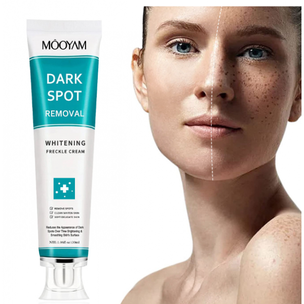 Крем відбілюючий для обличчя Mooyam Dark Spot Removal Whitening Freckle Cream, крем від ластовиння, 30 мл