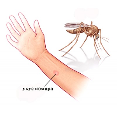 Защитите ребёнка от укусов: какие эфирные масла отпугивают комаров?